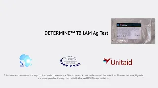 Procedure for Determine TB LAM test