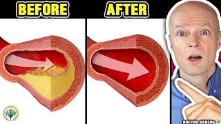 Slechts een glas van dit sap ... Verstopte slagaders omkeren en hoge bloeddruk verlagen - Dokter
