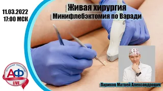 Минифлебэктомия по Варади на Актуальной Флебологии LIVE  11.03.2022 в 17-00