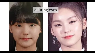 ITZY PLASTIC SURGERY ANALYSIS