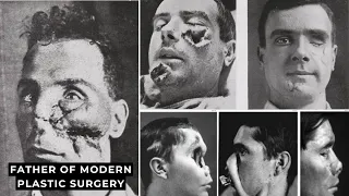 World War I Soldiers returned with brutal facial injuries