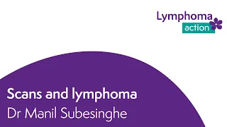 Scans and lymphoma Dr Manil Subesinghe