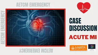 MBBS Case Discussion || Acute MI || World Heart Day