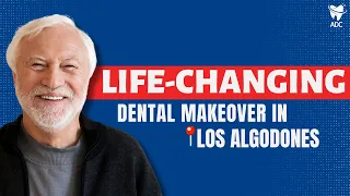 All on 4 Dental Implants in Los Algodones, Mexico Review: From MISSING Teeth To A Radiant Smile!