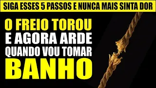 O MEU FREIO ROMPEU E ARDE QUANDO VOU TOMAR BANHO O QUE FAZER? FAÇA ESSAS 5 COISAS  E PRONTO