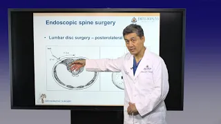 Innovative Approach to Minimally Invasive Surgery for Cervical and Lumbar Spine Surgery