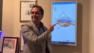 keratoconus & crosslinking Corrected: LONDON patient interviews Dr.Gulani, Day1 post surgery