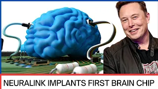 Elon Musk's Neuralink Implants First Patient With Brain Chip in 2024