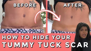 COVERING UP MY TUMMY TUCK SCAR! Using body makeup to really hide my tummy tuck scar!