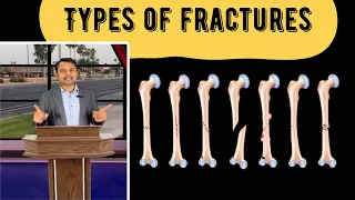 Common Types of Bone Fracture | 3D animation | Surgical Tech Show