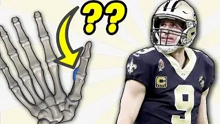 Doctor Reacts to Drew Brees Thumb Injury and Explains UCL Tears