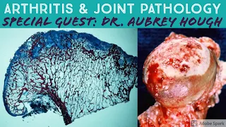 Osteoarthritis, Rheumatoid Arthritis & Joint Pathology: Special Guest Dr. Aubrey Hough