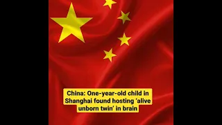 China's Shanghai, ‘alive unborn twin’ found in one-year-old child's brain