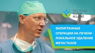 Филигранные операции на печени – локальное удаление метастаз.