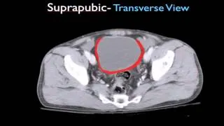 FAST Focused Assessment of Sonography in Trauma Part 1