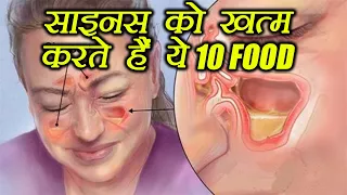 साइनस में खाऐं ये आहार | Food to get relief from Sinus Congestion | Boldsky