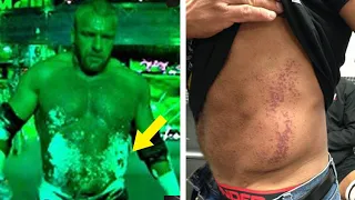 10 Worst WWE Wrestlemania Injuries