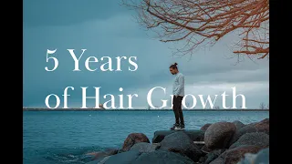 5 Years of Hair Growth | Men's Hair Growth Journey | 2022