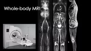 Imaging of Bone tumors New   Dr Mamdouh Mahfouz