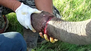 Lifesaving surgery to reconstruct the badly injured trunk of a poor elephant | Hunter's snare