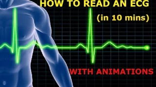 HOW TO READ AN ECG!! WITH ANIMATIONS(in 10 mins)!!