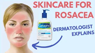 ROSACEA SKIN CARE | Dermatologist Review