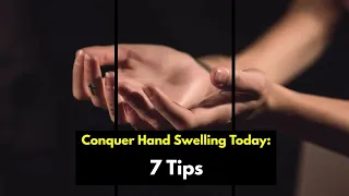 SWELLING IN THE HANDS AND FINGERS 👌: 13 MAIN CAUSES (AND WHAT TO DO)  🔥 #health