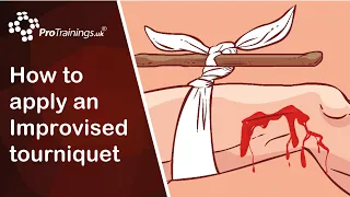 How to apply an Improvised tourniquet for catastrophic bleeding