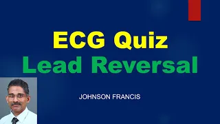 ECG Quiz - Lead Reversal