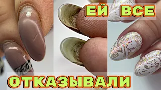 УЖАСНЫЕ ногти 😦 Клюющие ногти 😦 Сложная коррекция 💅 Красивый дизайн ногтей