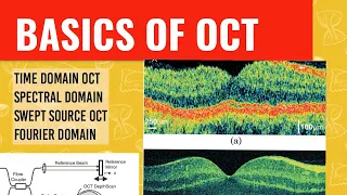 WHAT IS OCT || OCT technology explained ||