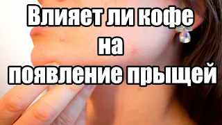 Влияет ли кофе на появление прыщей? Продукты провоцирующие прыщи. Вред кофе. Прыщи на лице.