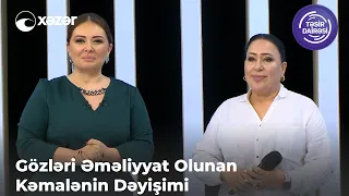 Gözləri Əməliyyat Olunan Kəmalənin Dəyişimi