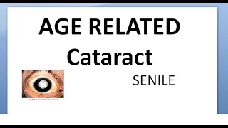 Ophthalmology 192 Age Related SENILE Cataract Causes Types Nuclear Second Vision Can see again near