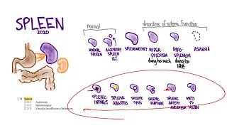 Spleen 03: focal lesions