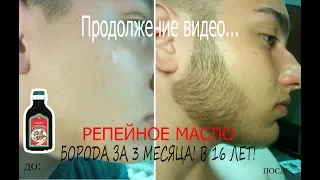 БОРОДА В 14-17 ЛЕТ! Репейное масло! Результаты!