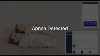 [mini-H] Demo test for apnea detection