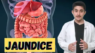 jaundice 3d animation | hemolytic obstructive hepatic  causes symptoms | class 11 cbse biology neet