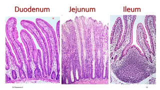 Histology of Duodenum, Jejunum & Ileum