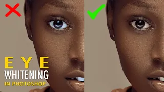 We Have Been Doing Eye & Teeth Whitening Wrong! Here Is The Best and Most Natural Way In Photoshop