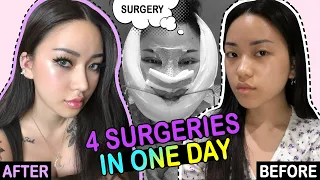 MY PLASTIC SURGERY IN KOREA PART2 │Recovery, Check-up, 2months post operation!