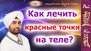 Как лечить красные точки на теле? - Харприт Сингх Хира