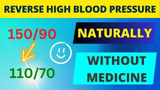 How To Control Hypertension Without Medicine (Manage High Blood Pressure at Home)