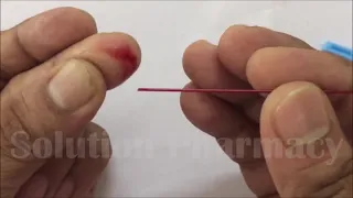 Blood Clotting Time Determination by Using Capillary Method | Blood Clotting Time Test | ENGLISH