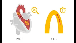 Echocardiography Pearl: Using strain imaging in cardiac oncology