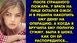 После страшного пожара у брата на лице остался ожог и я решила накопить ему денег на операцию…