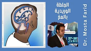 الجلطة الدماغية الوريدية و شرح مبسط مع د. مصطفى فريد