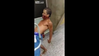 Man Presents as Zombie in Brazil Hospital