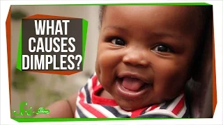 What Causes Dimples?