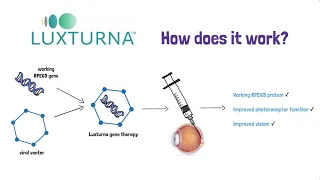 Retinitis Pigmentosa & Luxturna Gene Therapy Webinar